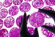 Staminali: Cellule della pelle trasformate in funzionanti cellule del fegato!