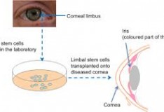 Staminali: Cellule corneali e architettura 3D per ridare la vista.