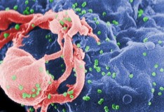 Virus Hiv e staminali