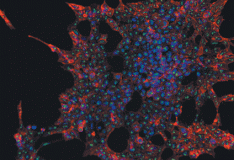 Staminali: Importante scoperta, identificata la proteina denominata “motore delle cellule”.