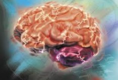Staminali: Concrete speranze per i bambini affetti da paralisi cerebrale.