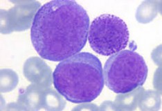 Staminali: Midollo osseo artificiale, un primo passo verso la cura della leucemia!
