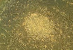 Cellule staminali coltivate senza l’uso di cellule umane o animali!
