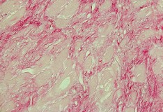 Staminali: Cellule cicatriziali del cuore tornano a battere!