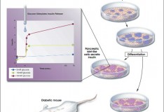Staminali: Nuova e rivoluzionaria terapia per il diabete!