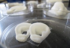 Staminali: Orecchie e nasi “prodotti” in laboratorio!