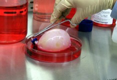 Staminali per curare le malattie della vescica incluso il cancro!