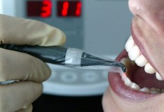 Trattare il diabete con le cellule staminali dei denti!