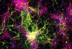 Staminali: Creare cellule nervose mature!