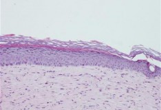 Staminali: Epidermide creata in laboratorio.