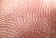 Cellule staminali embrionali umane da cellule adulte della pelle.