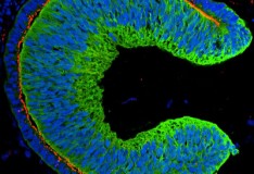 Staminali: Creata retina funzionale in laboratorio!