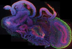 Creato il primo organo da cellule riprogrammate