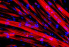 Staminali e il segreto nel creare nuovi muscoli